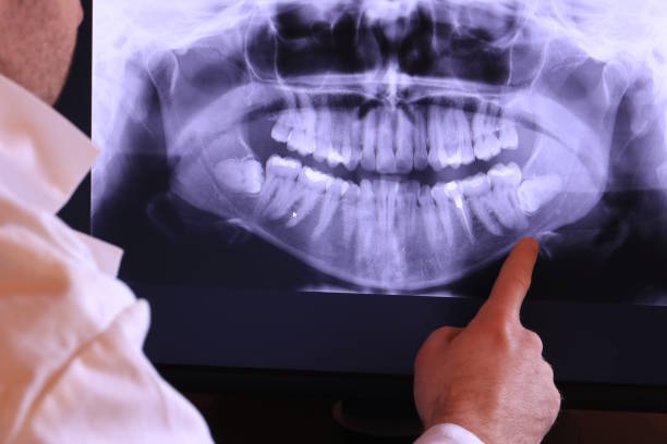 Best Urgent Care for Lost Fillings or Crowns in Exandria, AL