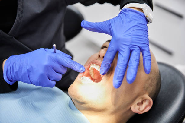 Best Emergency Dental Care for Broken or Chipped Teeth in Exandria, AL
