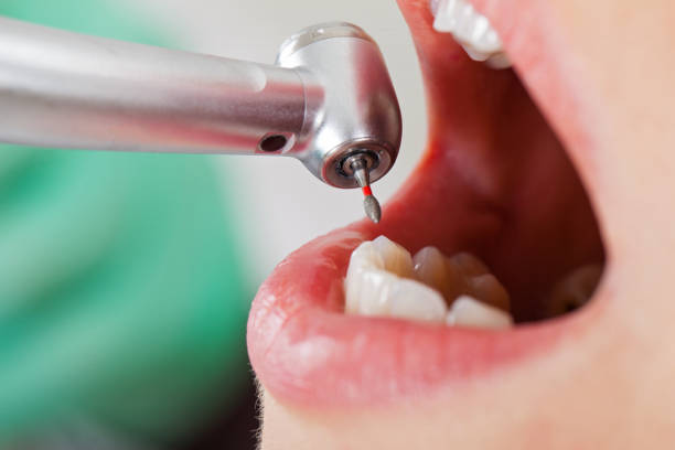 Best Emergency Gum Treatment in Exandria, AL